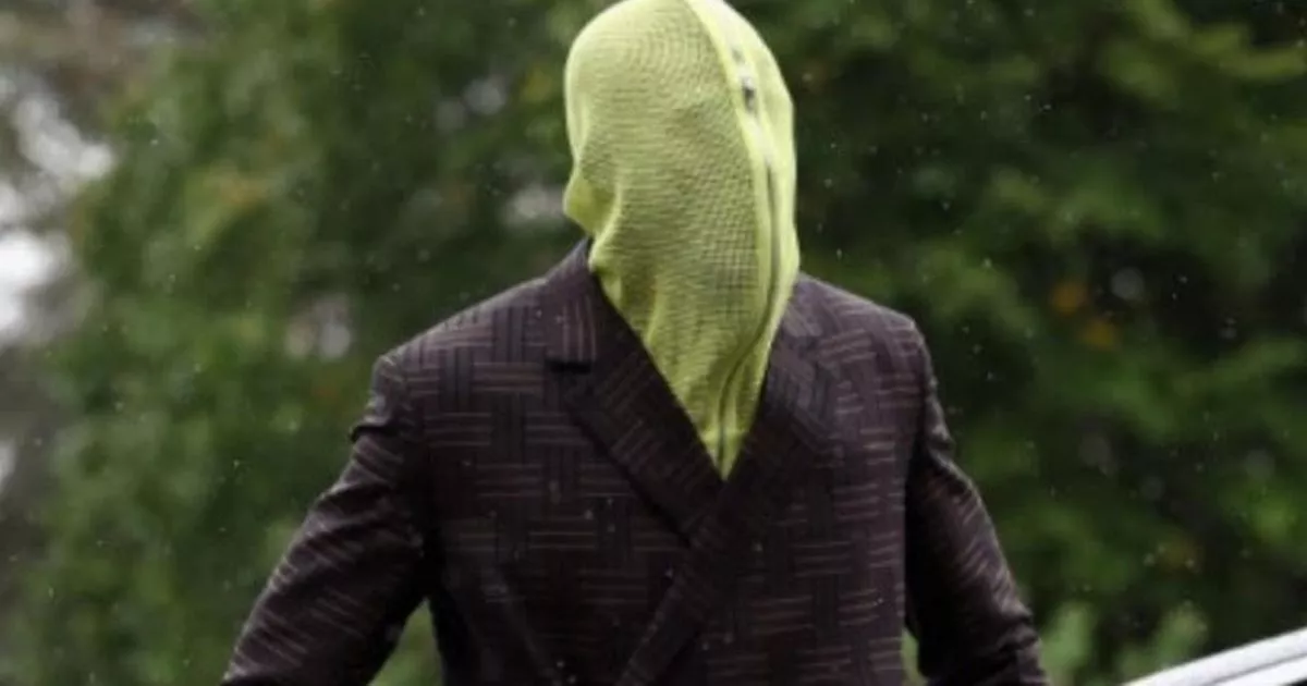 Konate tiết lộ từng “sợ tiêu tiền” dù nhận lương 70.000 bảng mỗi tuần